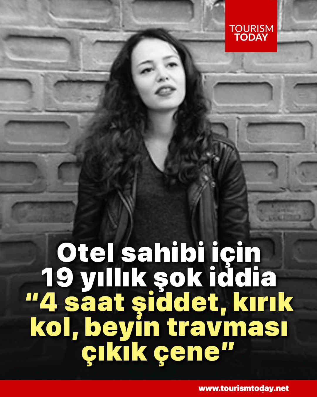 Otel sahibi için 19 yıllık şok iddia “4 saat şiddet, kırık kol, beyin travması, çıkık çene”